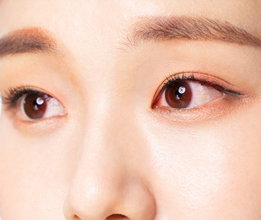 안구 건조증 충혈 증상 이미지